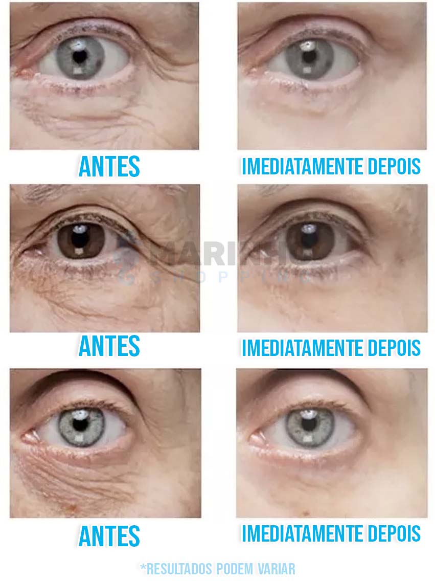 Creme Antirrugas Instantâneo DermaSkin