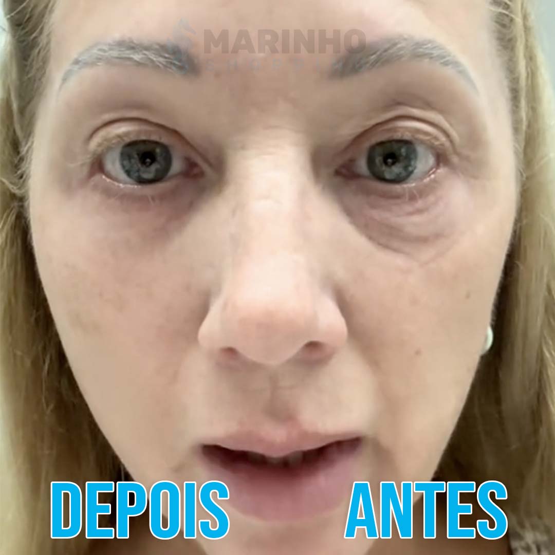 Creme Antirrugas Instantâneo DermaSkin