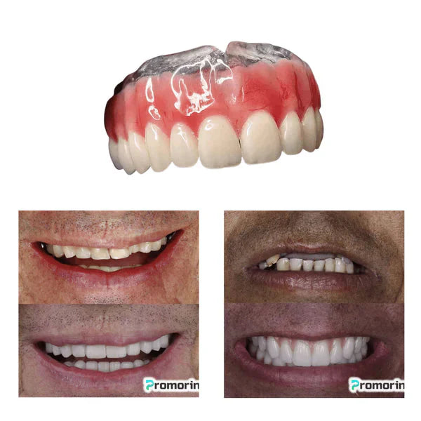 Dentadura de Silicone FIX | Ajustavel e Adaptativa